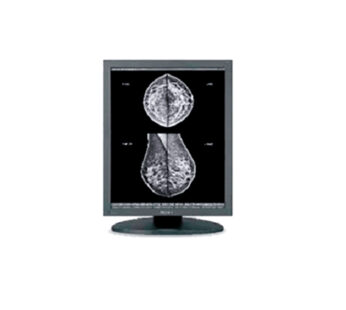 Monitor clínico para radiología