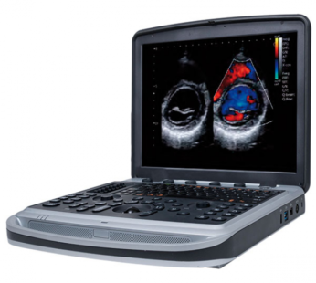 Chison SonoBook 9